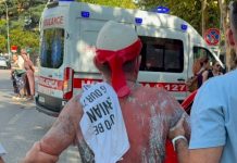 Ujë me ngjyrë blu, gaz lotsjellës dhe piper ndaj protestuesve, disa qytetarë dërgohen me ambulancë