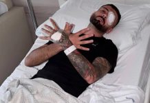 U plagos në sy gjatë protestës, reagon Erjon Vishkulli para operacionit në Itali: Zoti do të krijojë lehtësim pas vështirësive