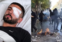 Prokuroria e Tiranës nis hetim për dëmtimin e Erjon Vishkullit, hetime edhe për dhunën e policisë në protesta
