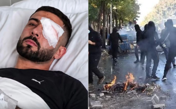 Prokuroria e Tiranës nis hetim për dëmtimin e Erjon Vishkullit, hetime edhe për dhunën e policisë në protesta