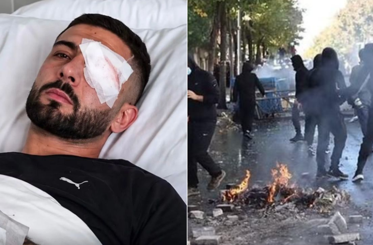 Prokuroria e Tiranës nis hetim për dëmtimin e Erjon Vishkullit, hetime edhe për dhunën e policisë në protesta